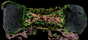 Single Cells of Human Bone, photo courtesy of Thomas Ambrosi